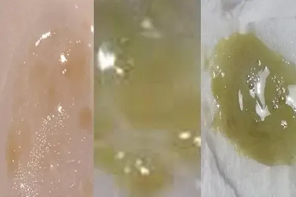 ho có đờm buổi sáng - Image 3