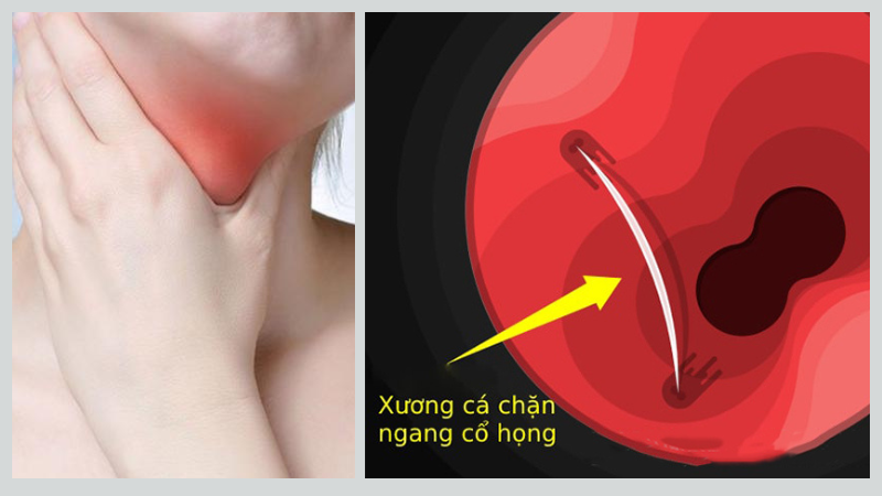 hoc xuong ca lau ngay co sao khong