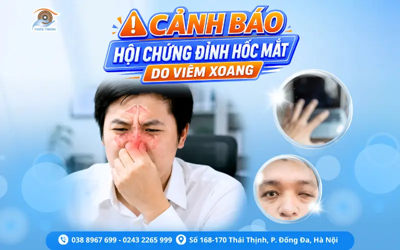 hội chứng đỉnh hốc mắt - Image 5