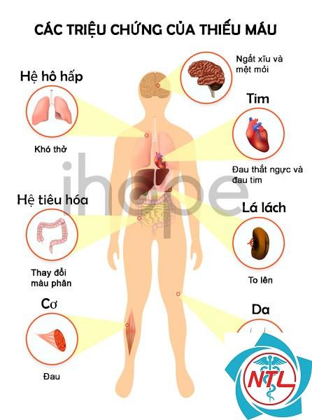 hội chứng urê huyết tán huyết - Image 3