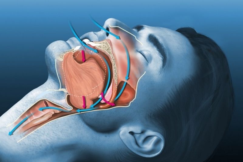 huyết áp tăng khi thiếu ngủ - Image 4