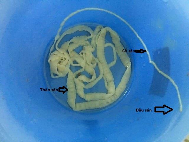ỉa ra giun - Image 2