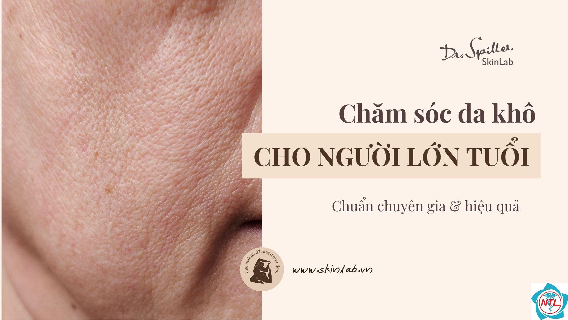 khô da ở người cao tuổi - Image 4