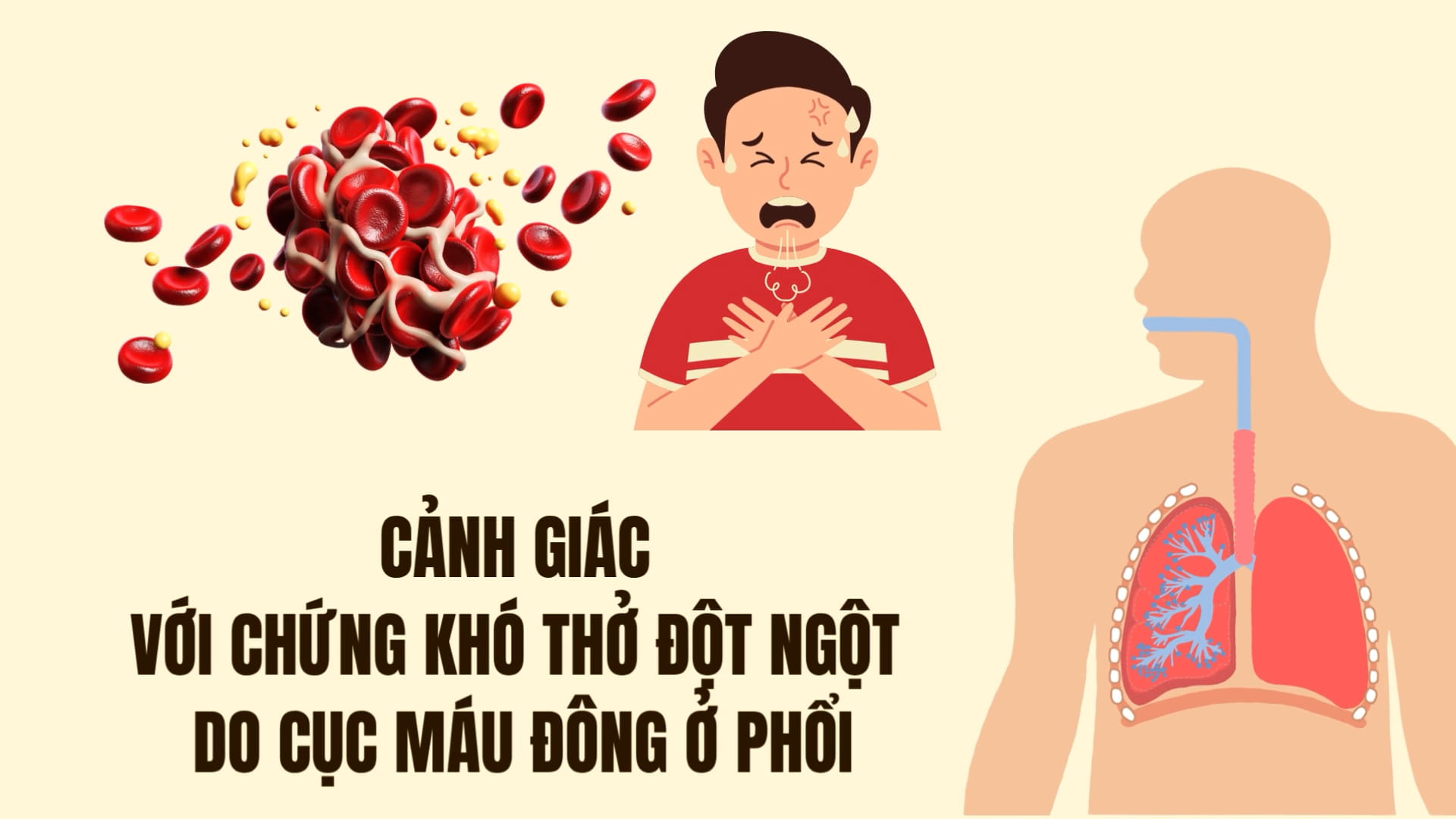 khó thở do phổi - Image 2