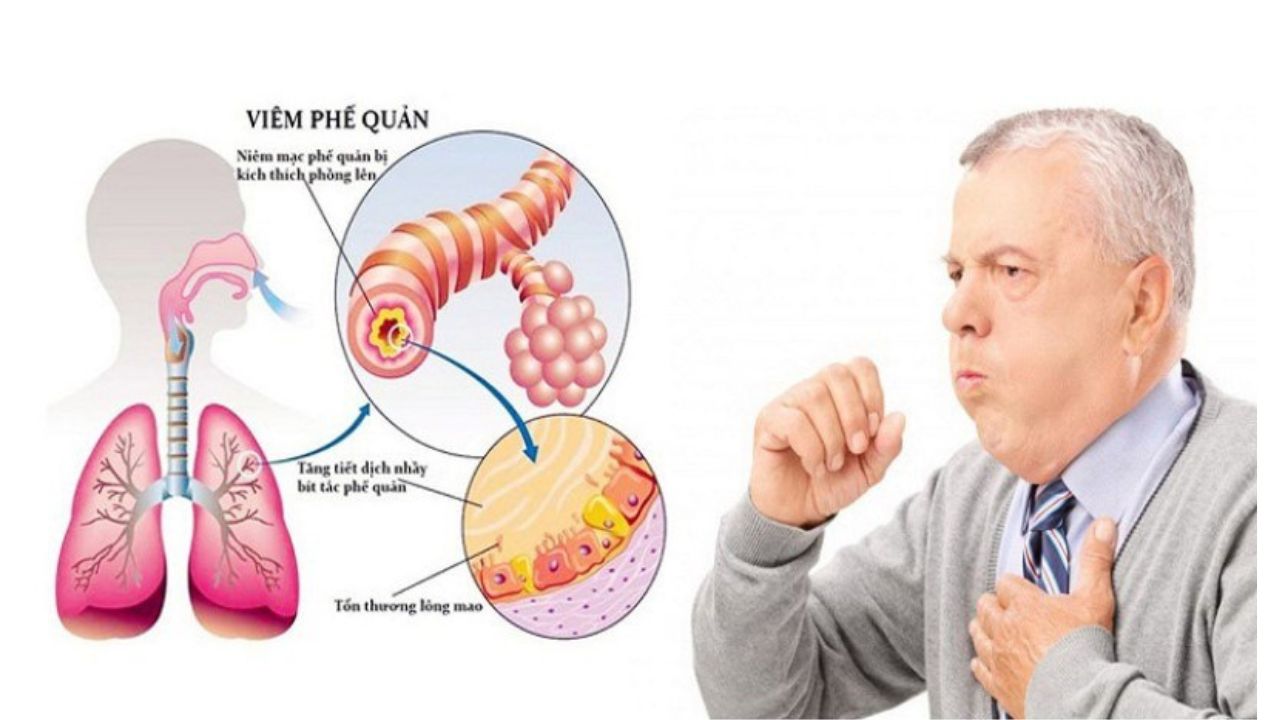 khó thở sau khi bị viêm phổi - Image 4