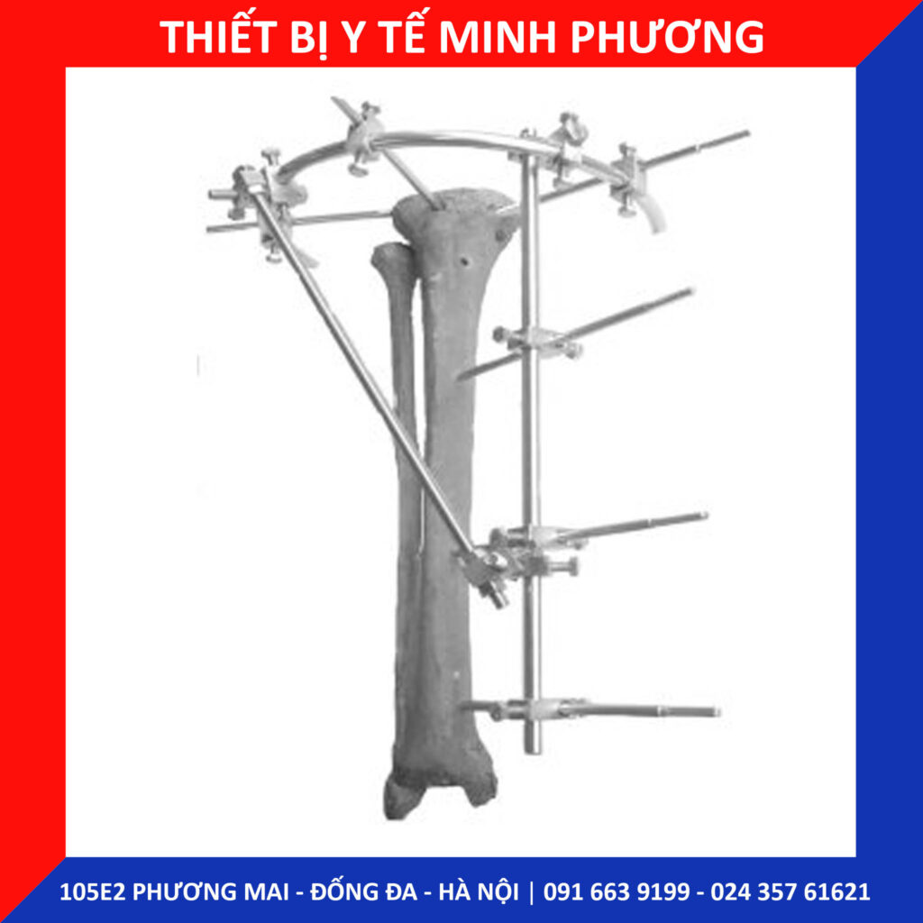khung cố định ngoài