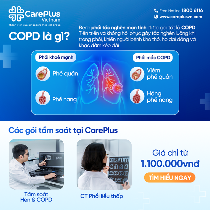 kiểm soát copd - Image 2
