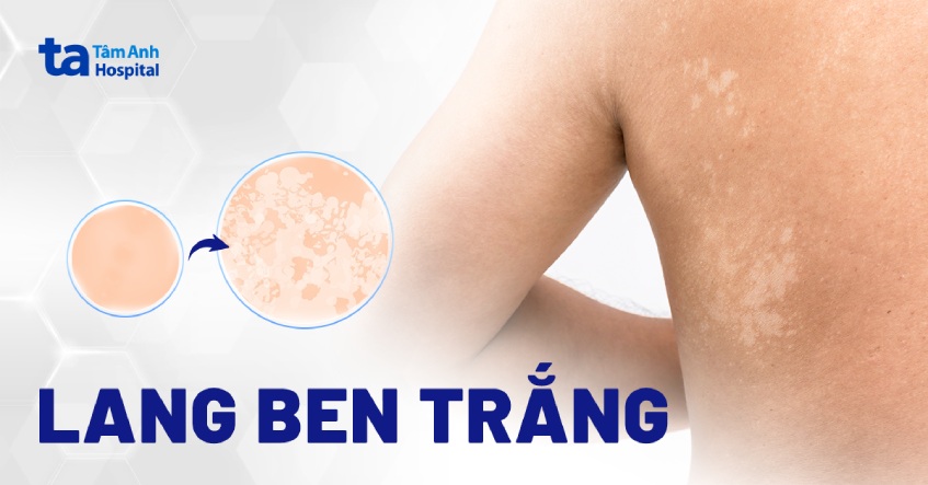 lang ben - Image 4