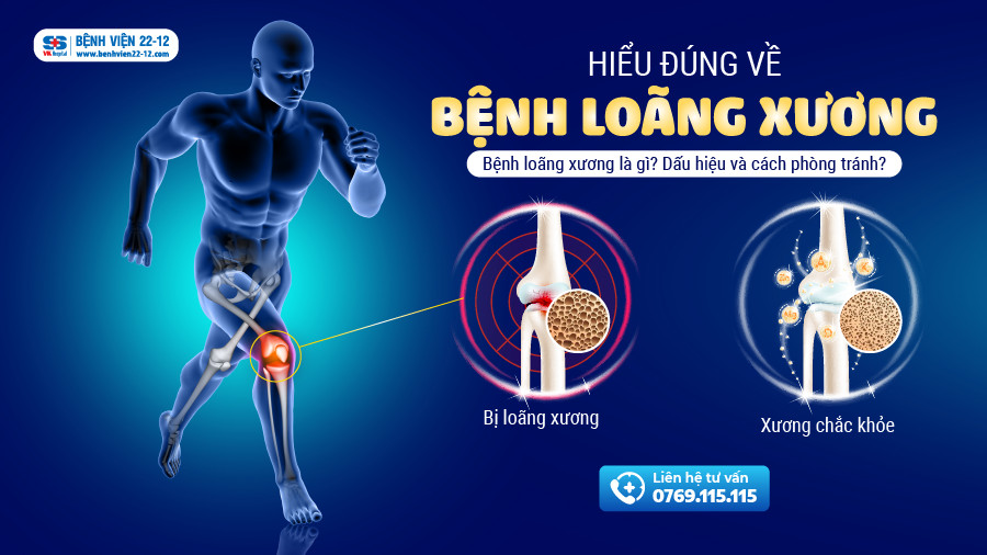 loãng xương là gì - Image 5