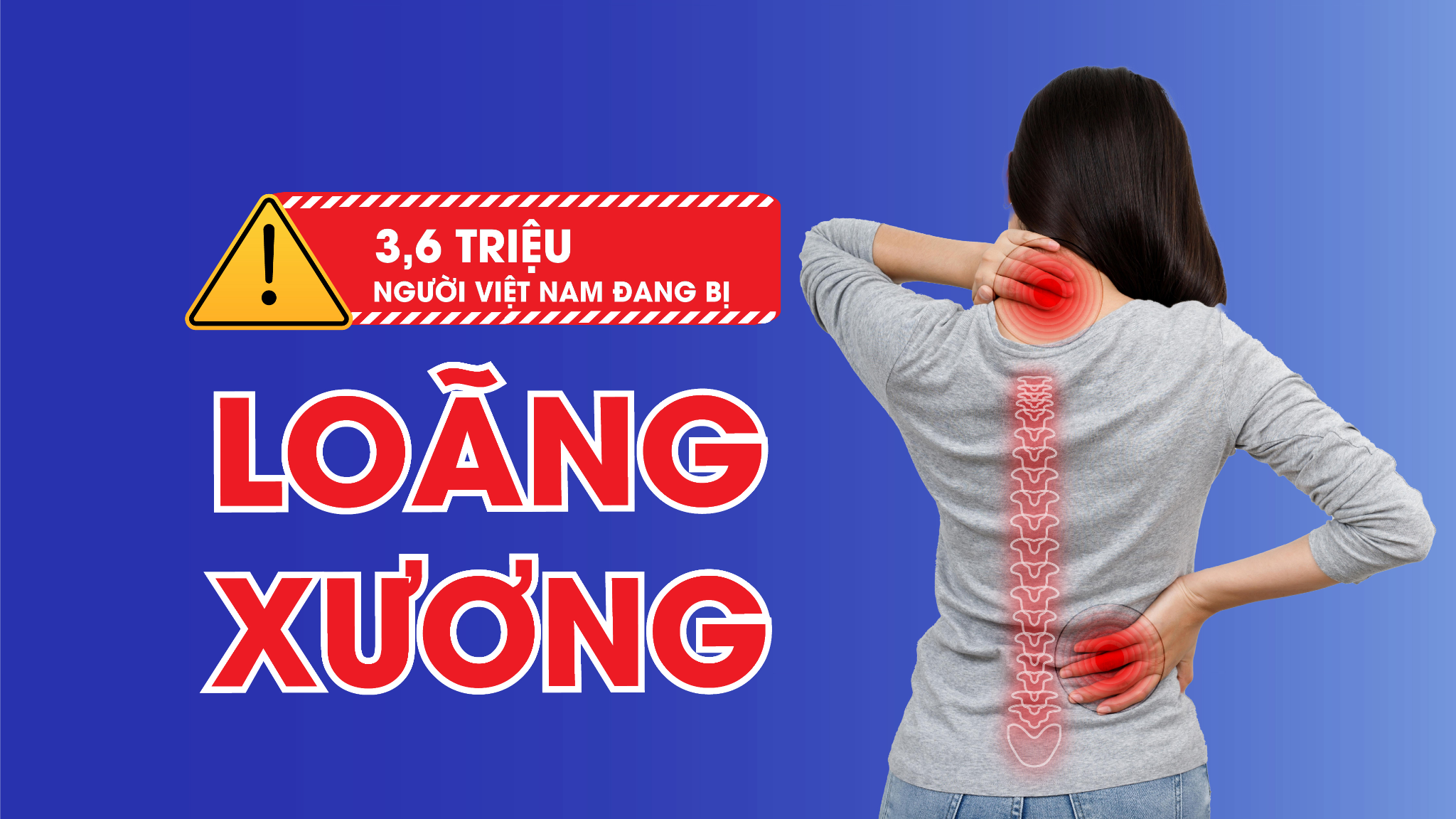 loãng xương sau gãy xương - Image 2