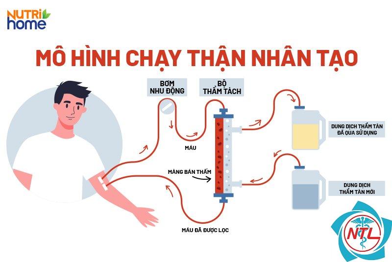 lọc máu - Image 2