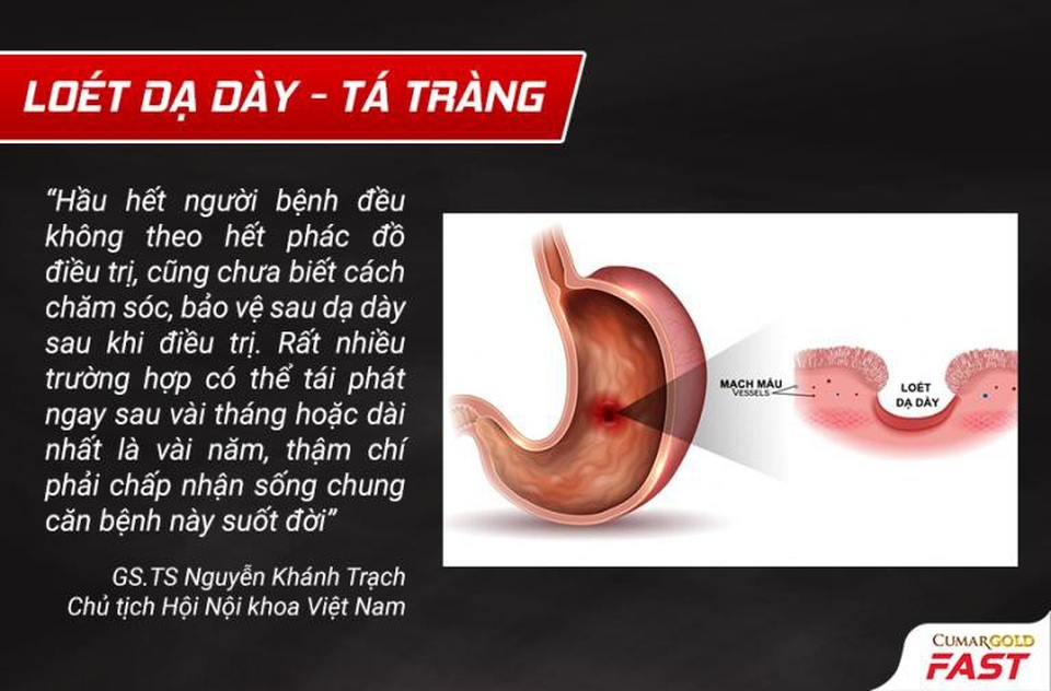 loét dạ dày tá tràng tái phát - Image 2