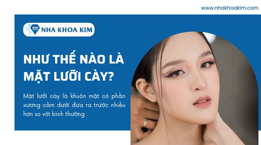 mặt gãy - Image 4