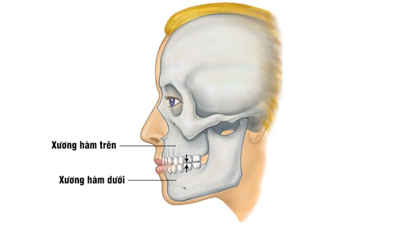 mặt xương - Image 3