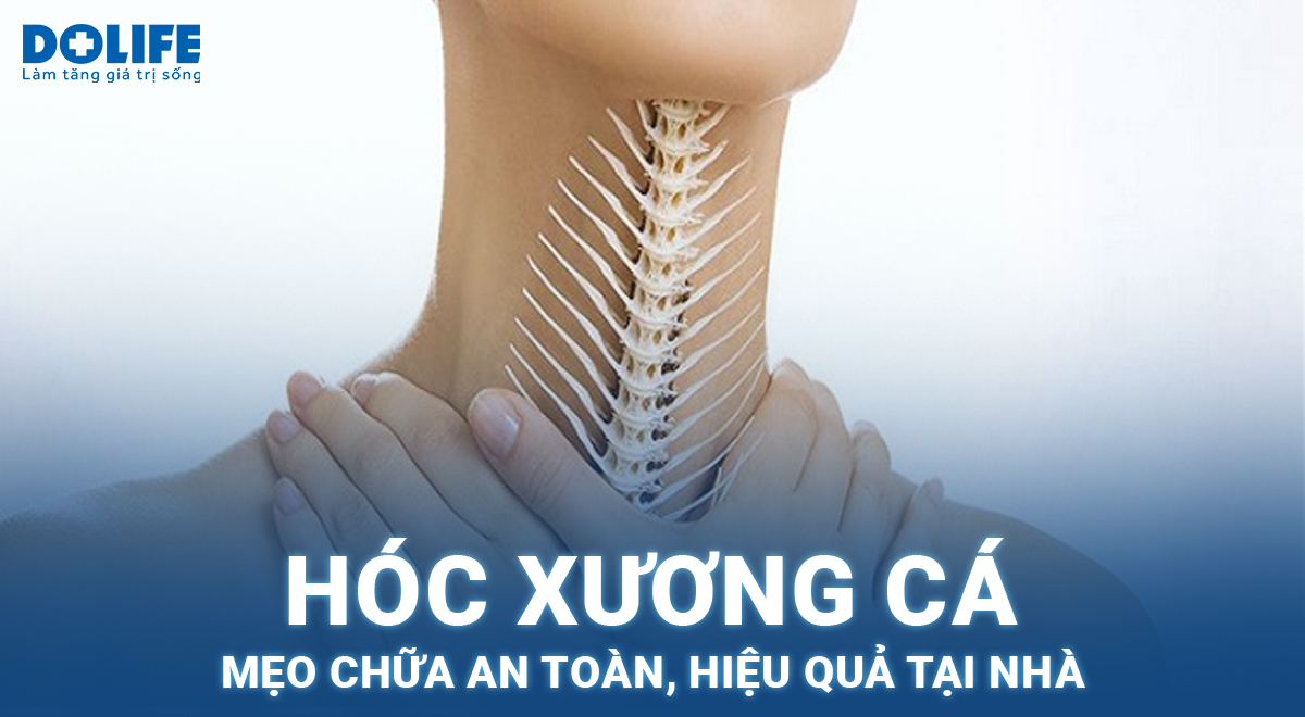 meo chua mac xuong ca - Image 4