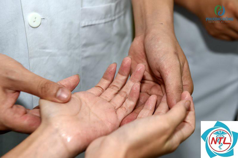 mồ hôi trộm trên da - Image 1
