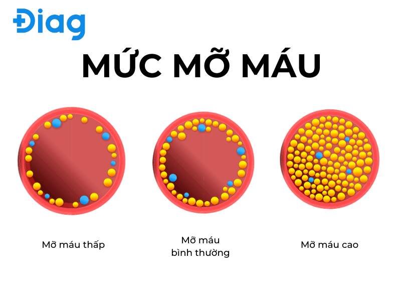 mỡ máu cao là gì - Image 5