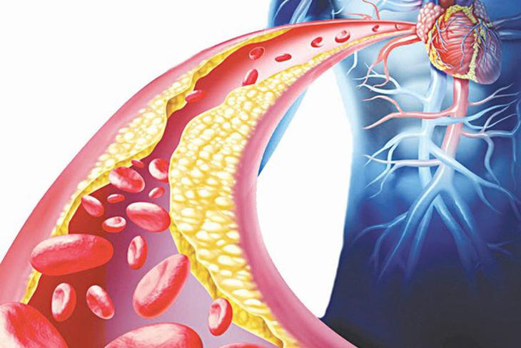 mỡ máu cao ở người cao tuổi - Image 4