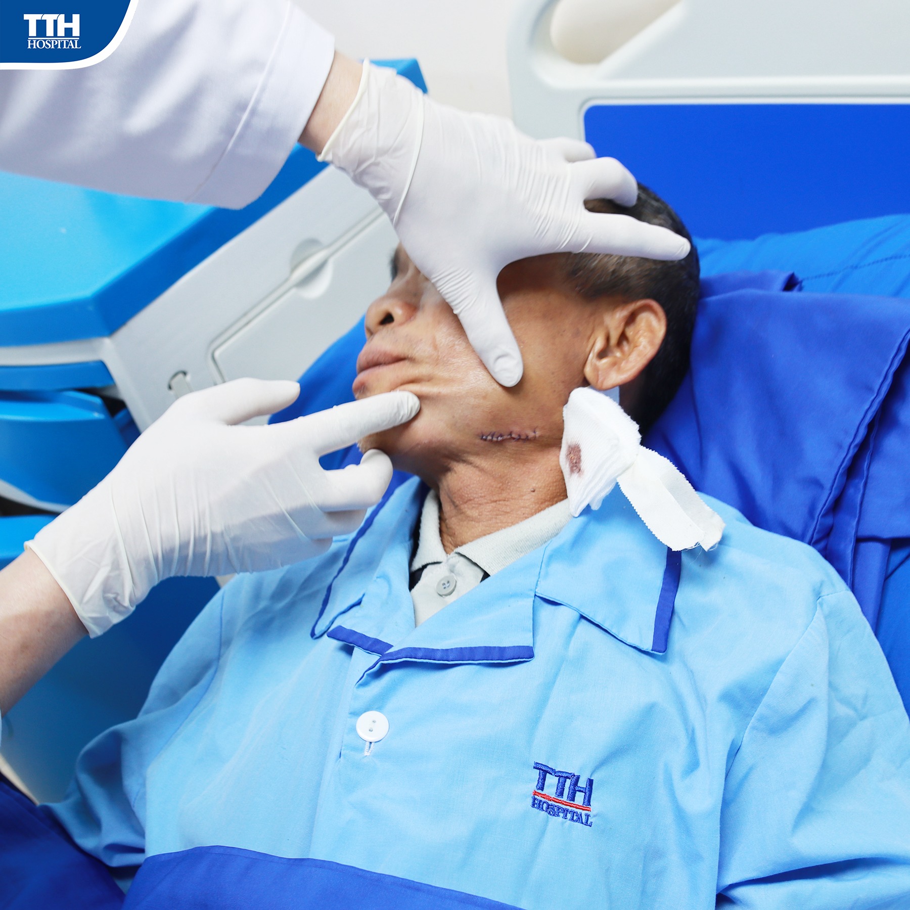 mổ tháo nẹp vít xương hàm dưới - Image 2