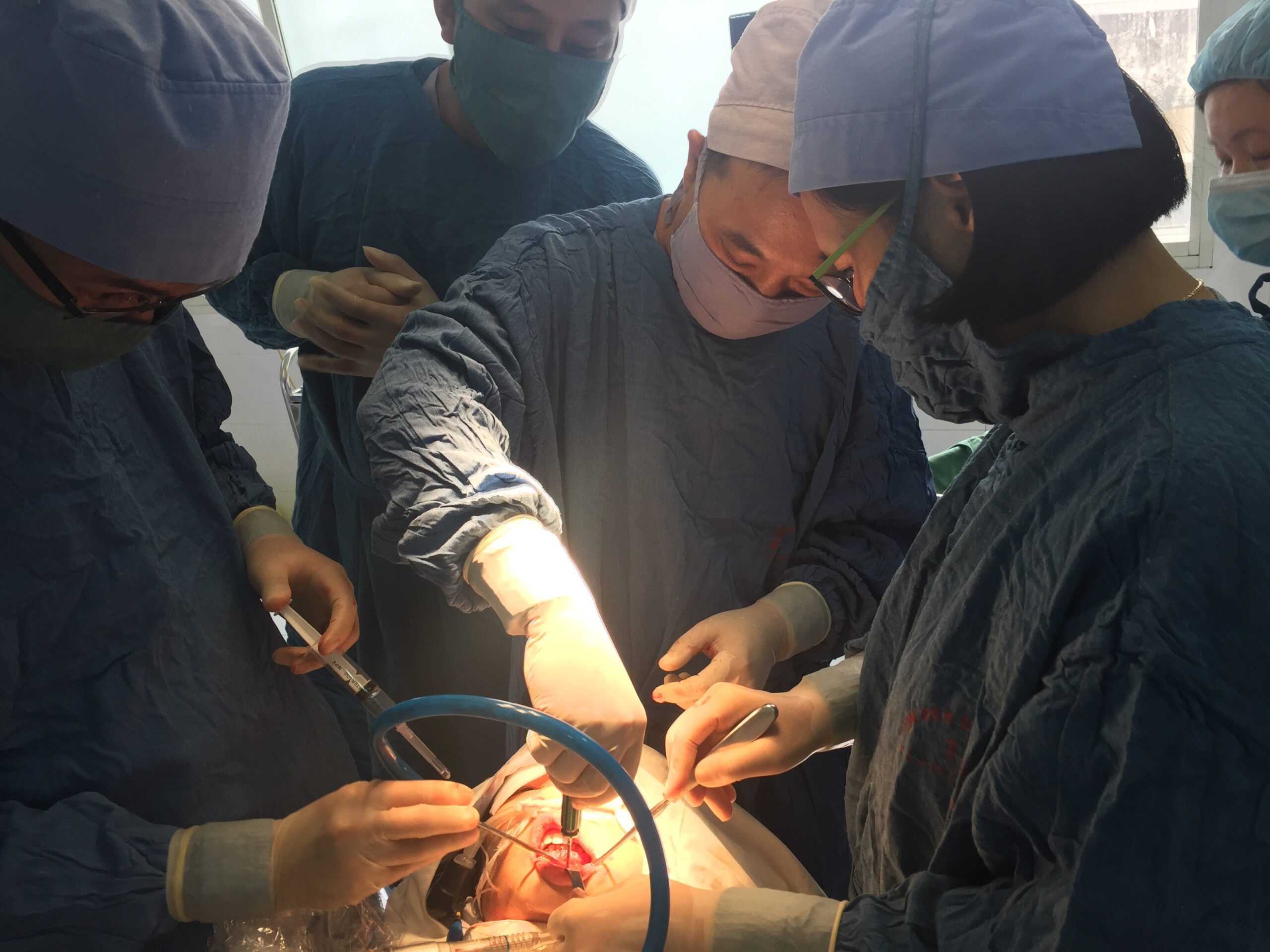 mổ tháo nẹp vít xương hàm dưới - Image 4
