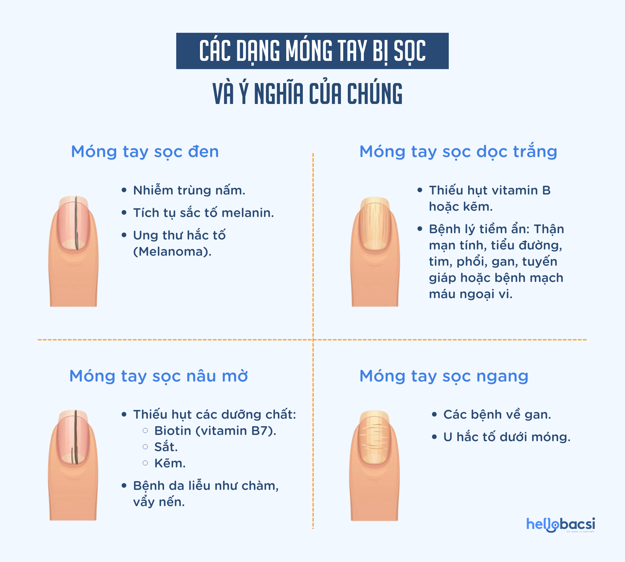 móng tay có sọc - Image 2