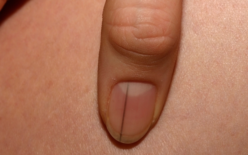 móng tay có sọc - Image 5