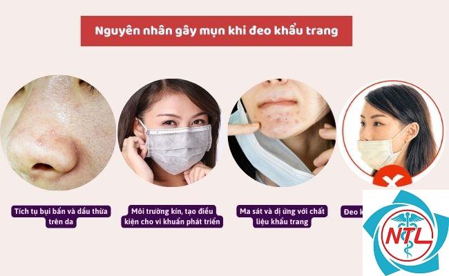 mụn do khẩu trang - Image 2