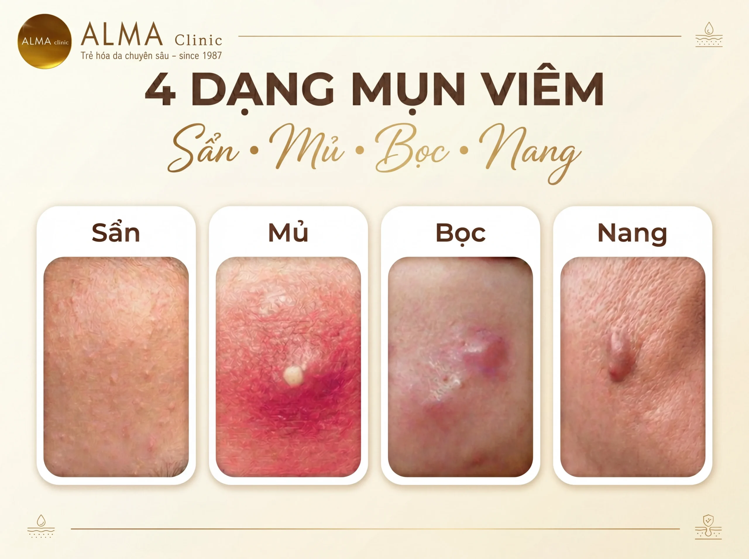 mụn viêm - Image 5