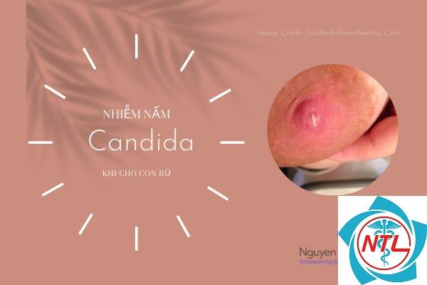 nấm candida dưới vú - Image 2