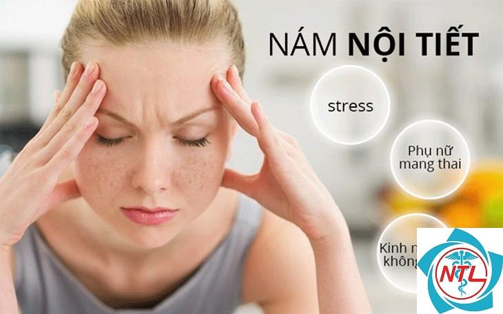 nám da do nội tiết