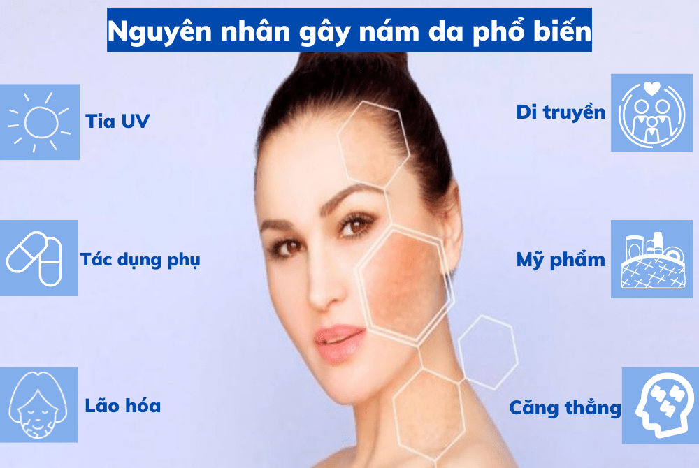 nám da ở phụ nữ - Image 2