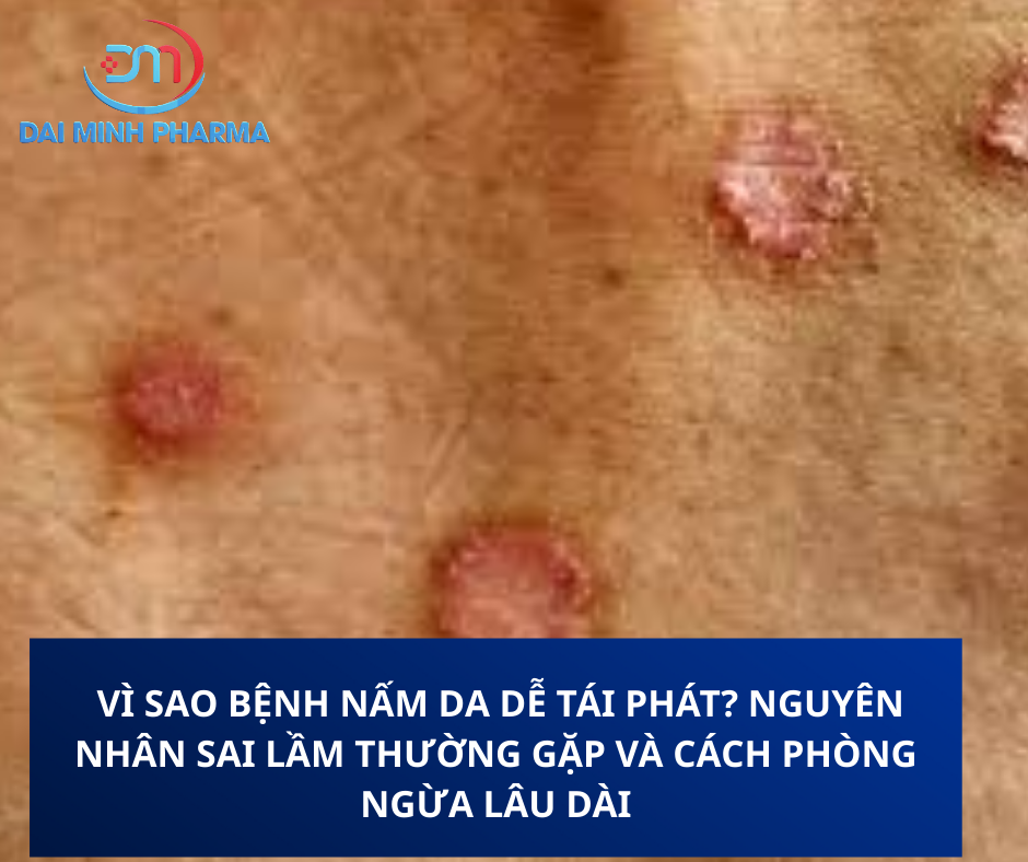 nấm da tái phát - Image 2