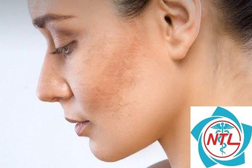 nám nội tiết
