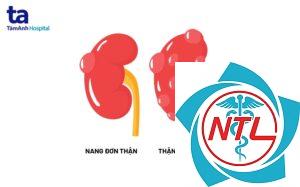 nang thận đơn giản