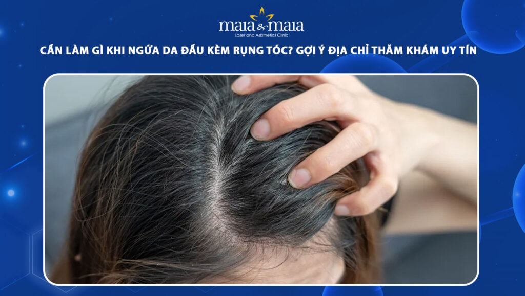 ngứa da đầu và rụng tóc - Image 3