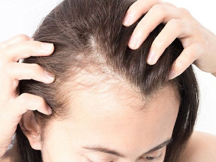 ngứa da đầu và rụng tóc