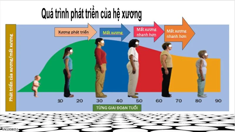 nguy cơ gãy xương ở người loãng xương - Image 4