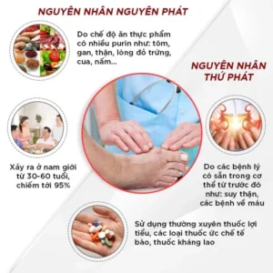 nguyên nhân bệnh gout