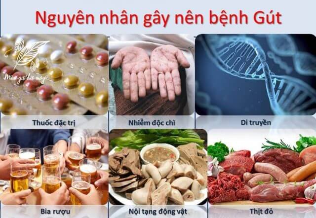 nguyên nhân bệnh gout - Image 4