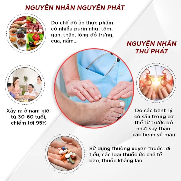 nguyên nhân bệnh gout