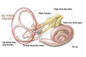 nguyên nhân chóng mặt