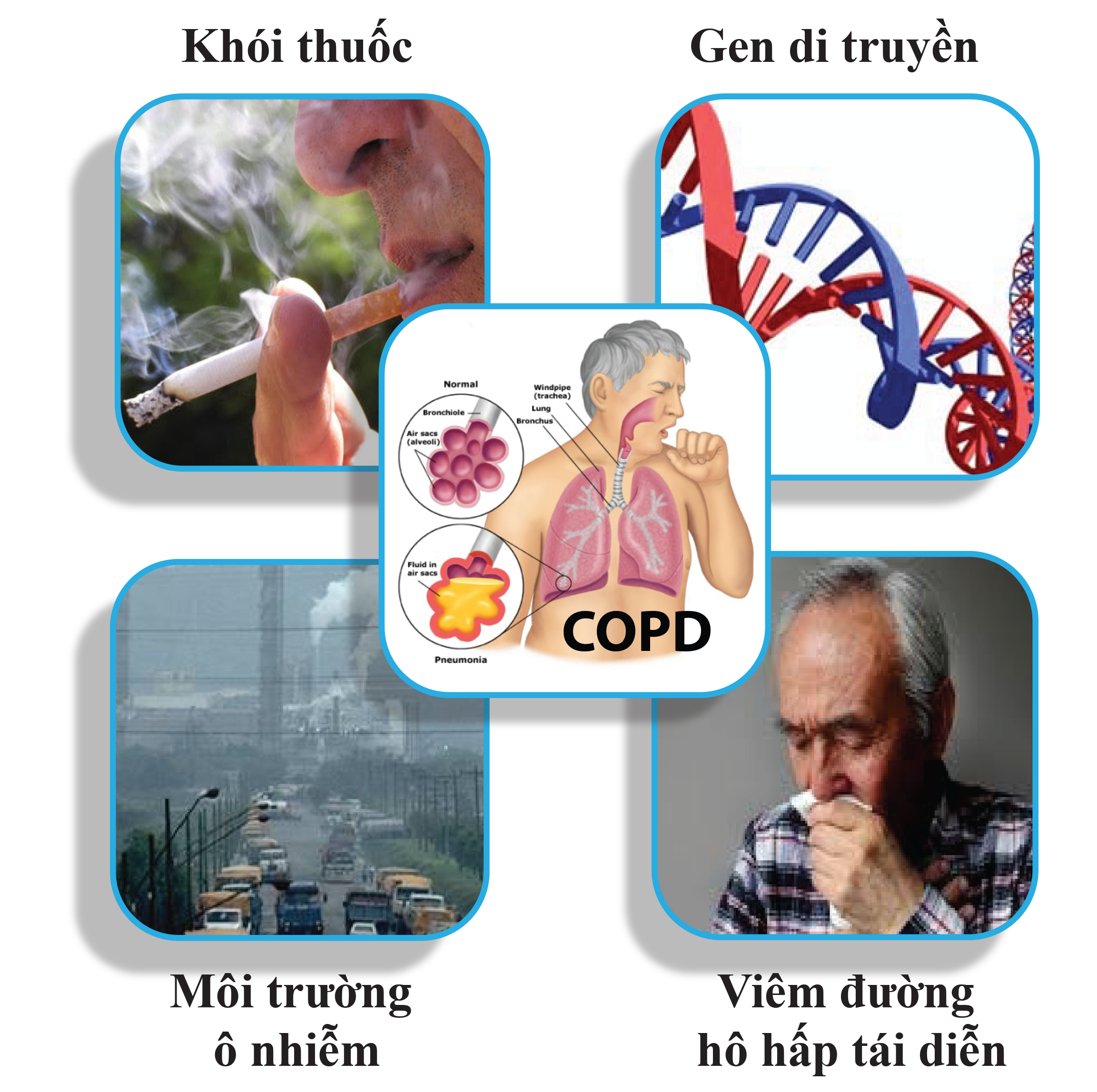 nguyên nhân copd - Image 4