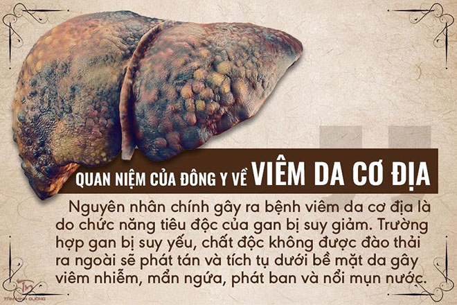 nguyên nhân của viêm da cơ địa - Image 2