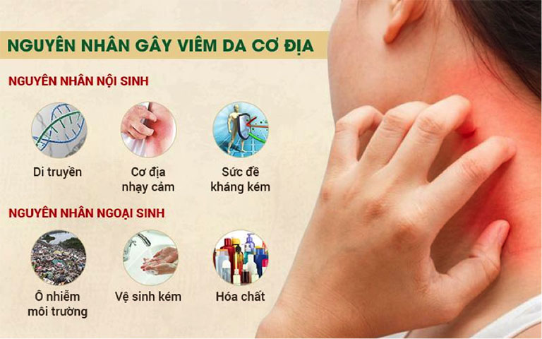 nguyên nhân của viêm da cơ địa - Image 3