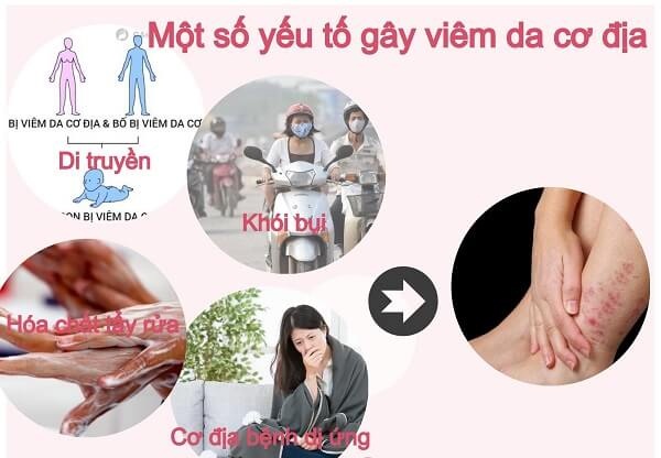 nguyên nhân của viêm da cơ địa