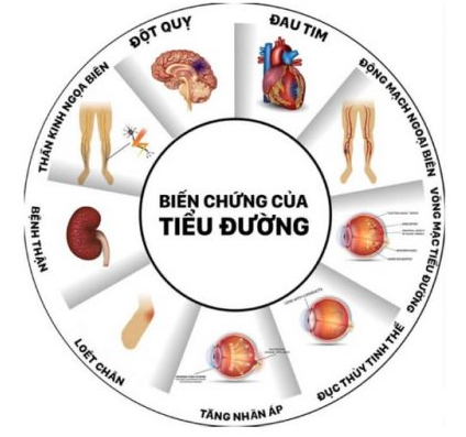 nguyên nhân đái tháo đường - Image 3