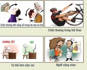 nguyên nhân dẫn đến gãy xương