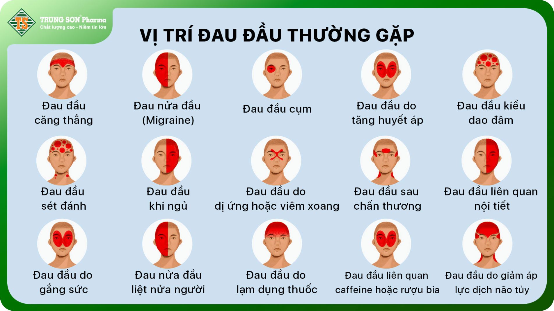nguyên nhân đau đầu - Image 3