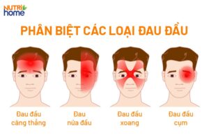 nguyên nhân đau đầu