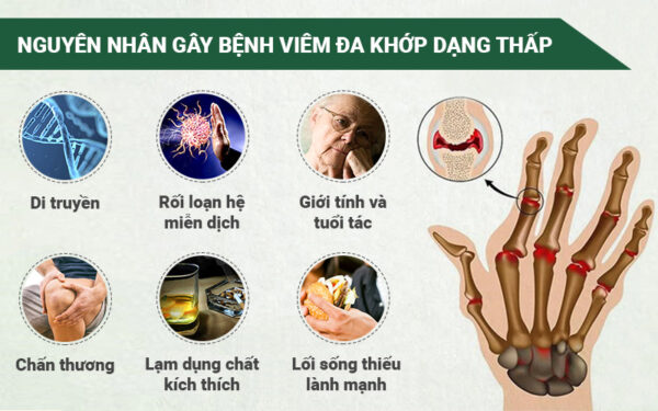 nguyên nhân đau khớp - Image 3